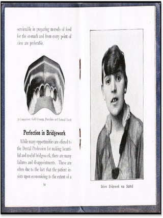From Baby Teeth to Wisdom Teeth and Modern Bridgework