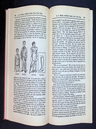 Manual of Artificial Limbs: An Exhaustive Exposition of Prosthesis ['Copiously Illustrated']