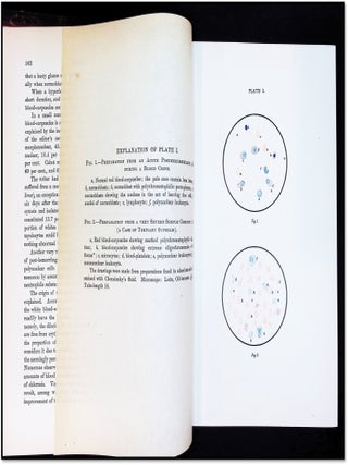 Diseases of the Blood [Nothnagel's Practice &mdash; American Edition &mdash; Early Hematology]